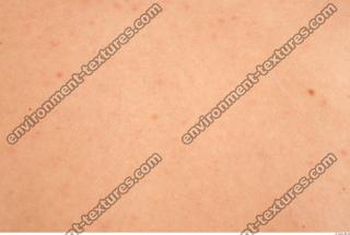 photo texture of white skin 0004